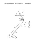 METHOD OF TREATING INCONTINENCE diagram and image