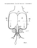 Closing system for a natural or artificial anus diagram and image