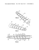 OVER MOLDED IMPLANTABLE DEVICE TO PROTECT TUBING FROM PUNCTURE diagram and image