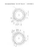 Surgical Retention Port and Method of Use diagram and image