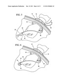 Manifold for laparoscopic seal assembly diagram and image