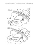 Manifold for laparoscopic seal assembly diagram and image