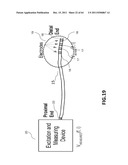 Methods and Systems for Determining Vascular Bodily Lumen Information and     Guiding Medical Devices diagram and image