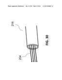 Methods and Systems for Determining Vascular Bodily Lumen Information and     Guiding Medical Devices diagram and image