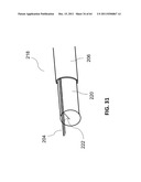 Methods and Systems for Determining Vascular Bodily Lumen Information and     Guiding Medical Devices diagram and image