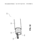 Methods and Systems for Determining Vascular Bodily Lumen Information and     Guiding Medical Devices diagram and image