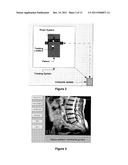 SYSTEM FOR PERFORMING HIGHLY ACCURATE SURGERY diagram and image