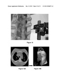 SYSTEM FOR PERFORMING HIGHLY ACCURATE SURGERY diagram and image