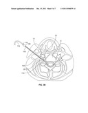 METHODS AND DEVICES FOR TREATING TISSUE diagram and image