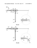 METHODS AND DEVICES FOR TREATING TISSUE diagram and image