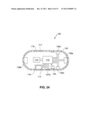 CAPSULE AND METHOD FOR TREATING OR DIAGNOSING CONDITIONS OR DISEASES OF     THE INTESTINAL TRACT diagram and image