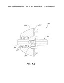 REMOVABLE CASSETTE FOR ARTICULAR INJECTION SYSTEM diagram and image