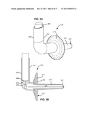 SELF-SEALING DEVICE AND METHOD FOR DELIVERY OF A THERAPEUTIC AGENT THROUGH     A PNEUMOSTOMA diagram and image