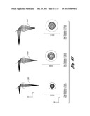 LASER-BASED METHOD AND SYSTEM FOR SELECTIVELY PROCESSING TARGET TISSUE     MATERIAL IN A PATIENT AND OPTICAL CATHETER ASSEMBLY FOR USE THEREIN diagram and image