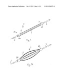 ARRANGEMENT FOR INTERNAL BONE SUPPORT diagram and image