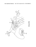 SYSTEMS AND METHODS FOR TREATMENT OF COMPRESSED NERVES diagram and image