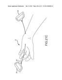 SYSTEMS AND METHODS FOR TREATMENT OF COMPRESSED NERVES diagram and image