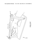 SYSTEMS AND METHODS FOR TREATMENT OF COMPRESSED NERVES diagram and image