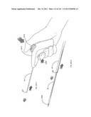 SYSTEMS AND METHODS FOR TREATMENT OF COMPRESSED NERVES diagram and image