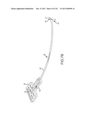 SYSTEMS AND METHODS FOR TREATMENT OF COMPRESSED NERVES diagram and image