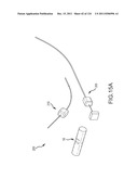 SYSTEMS AND METHODS FOR TREATMENT OF COMPRESSED NERVES diagram and image