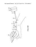 SYSTEMS AND METHODS FOR TREATMENT OF COMPRESSED NERVES diagram and image