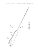 SYSTEMS AND METHODS FOR TREATMENT OF COMPRESSED NERVES diagram and image