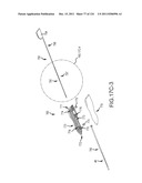 SYSTEMS AND METHODS FOR TREATMENT OF COMPRESSED NERVES diagram and image