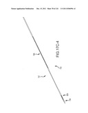 SYSTEMS AND METHODS FOR TREATMENT OF COMPRESSED NERVES diagram and image