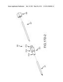 SYSTEMS AND METHODS FOR TREATMENT OF COMPRESSED NERVES diagram and image