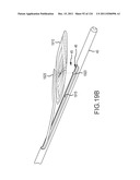 SYSTEMS AND METHODS FOR TREATMENT OF COMPRESSED NERVES diagram and image