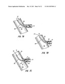 PERCUTANEOUS CATHETER DIRECTED INTRAVASCULAR OCCLUSION DEVICES diagram and image