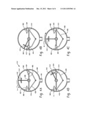 OSCILLATING TISSUE DISSECTOR diagram and image