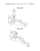 EMBOLIC PROTECTION SYSTEM diagram and image