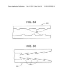 EMBOLIC PROTECTION SYSTEM diagram and image