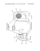 SYSTEMS AND METHODS FOR PREVENTING FORMATION OF BLOOD CLOTS IN THE LEFT     ATRIUM diagram and image