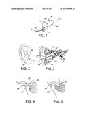 EAR INSERT FOR RELIEF OF TMJ DISCOMFORT diagram and image