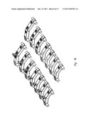 Spinous Process Cross-Link diagram and image