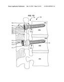 ADAPTIVE SPINAL ROD AND METHODS FOR STABILIZATION OF THE SPINE diagram and image