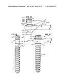 ADAPTIVE SPINAL ROD AND METHODS FOR STABILIZATION OF THE SPINE diagram and image