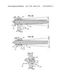 ADAPTIVE SPINAL ROD AND METHODS FOR STABILIZATION OF THE SPINE diagram and image