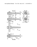 ADAPTIVE SPINAL ROD AND METHODS FOR STABILIZATION OF THE SPINE diagram and image