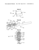 ADAPTIVE SPINAL ROD AND METHODS FOR STABILIZATION OF THE SPINE diagram and image