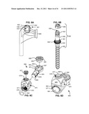 ADAPTIVE SPINAL ROD AND METHODS FOR STABILIZATION OF THE SPINE diagram and image