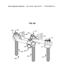 ADAPTIVE SPINAL ROD AND METHODS FOR STABILIZATION OF THE SPINE diagram and image