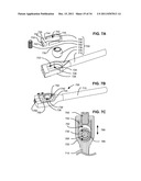 ADAPTIVE SPINAL ROD AND METHODS FOR STABILIZATION OF THE SPINE diagram and image