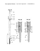 ADAPTIVE SPINAL ROD AND METHODS FOR STABILIZATION OF THE SPINE diagram and image