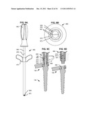 ADAPTIVE SPINAL ROD AND METHODS FOR STABILIZATION OF THE SPINE diagram and image