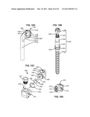 ADAPTIVE SPINAL ROD AND METHODS FOR STABILIZATION OF THE SPINE diagram and image