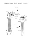 ADAPTIVE SPINAL ROD AND METHODS FOR STABILIZATION OF THE SPINE diagram and image